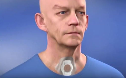 Discovery to alter the path of bionic voice research worldwide 