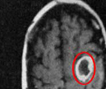 MRI scan thumbnail