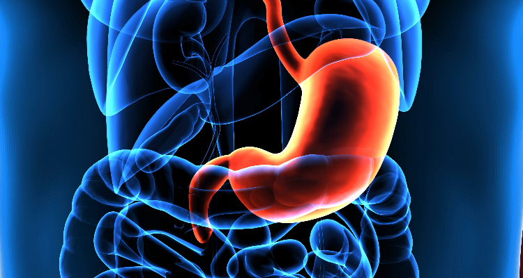 Gastric Cancer