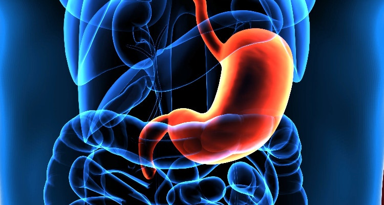 Gastric Cancer